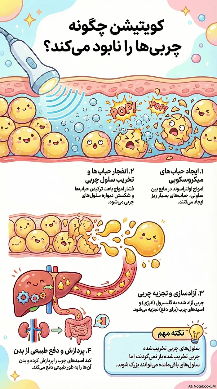 لاغری با دستگاه کویتیشن