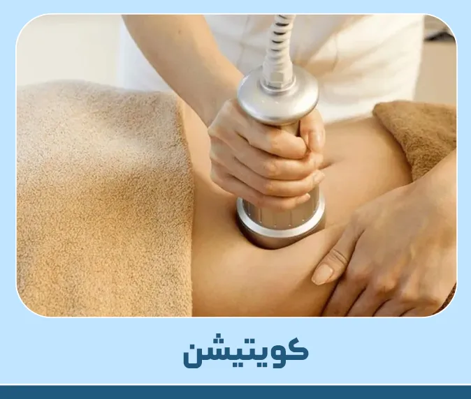 کویتیشن