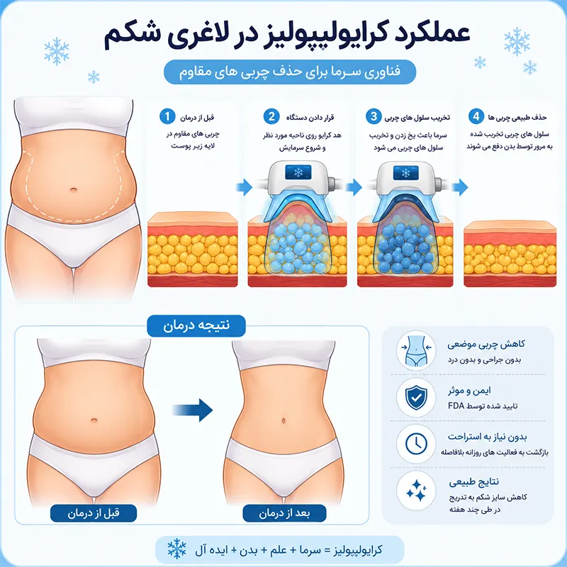 کرایولیپولیز