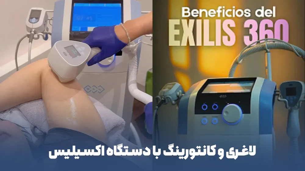 لاغری و کانتورینگ صورت و بدن با دستگاه اکسیلیس