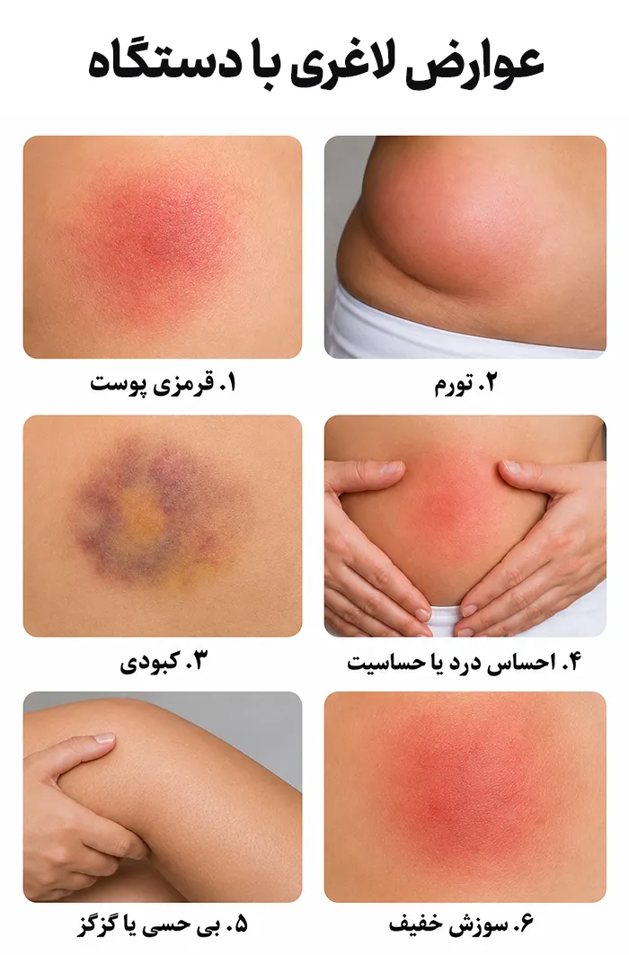 شایع ترین عوارض لاغری با دستگاه