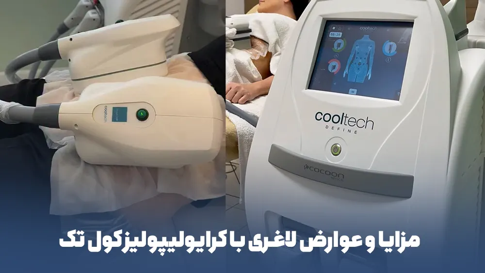 مزایا و عوارض لاغری با کرایولیپولیز کول تک
