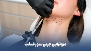 مزوتراپی چربی سوز غبغب